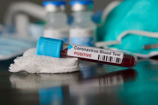 Read more about the article Everything you need to know about the coronavirus